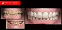 Dr Zenaidy Castro Celebrity Smile Makeovers specialist | The best #1 Cosmetic Dentist Melbourne CBD