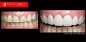 Dr Zenaidy Castro Celebrity Smile Makeovers specialist | The best #1 Cosmetic Dentist Melbourne CBD