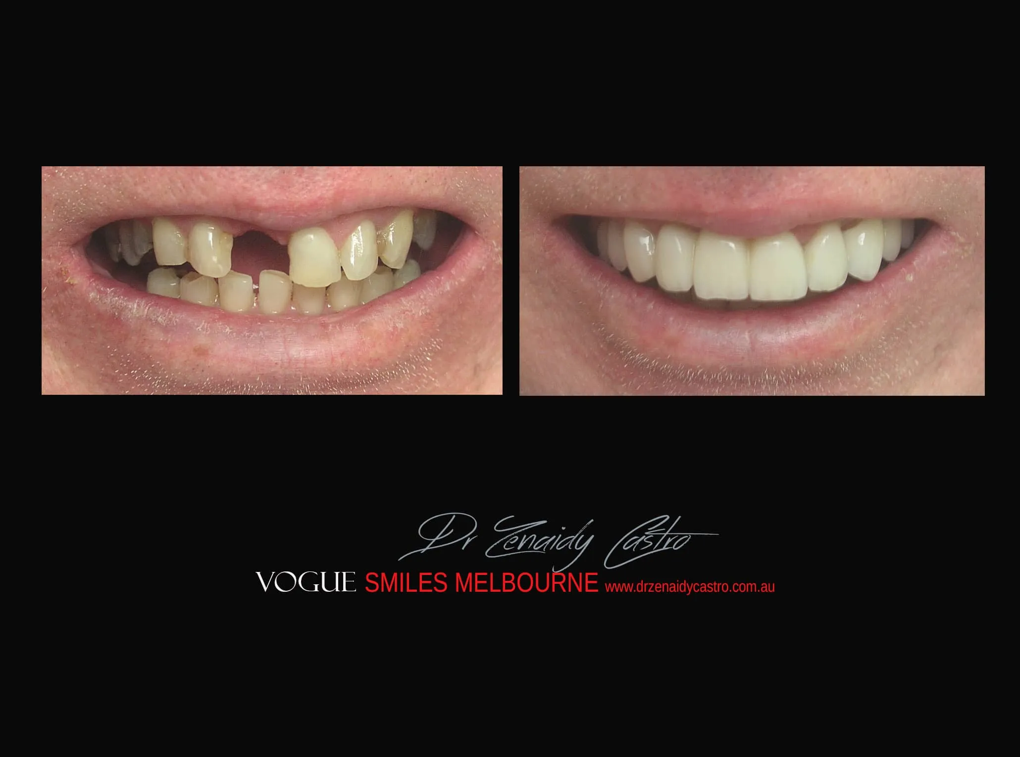 Different Types of Cosmetic Dentistry Procedures in Melbourne CBD. Types of Cosmetic Dentistry Treatments. Cosmetic Dentistry Services