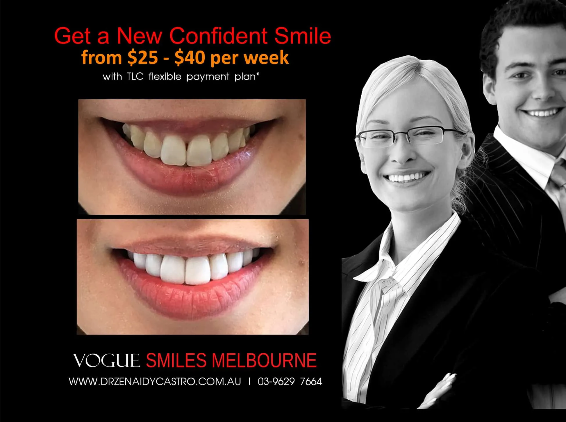 Teeth Whitening Cost and FAQs - How Much Does Teeth Whitening Cost In Melbourne?