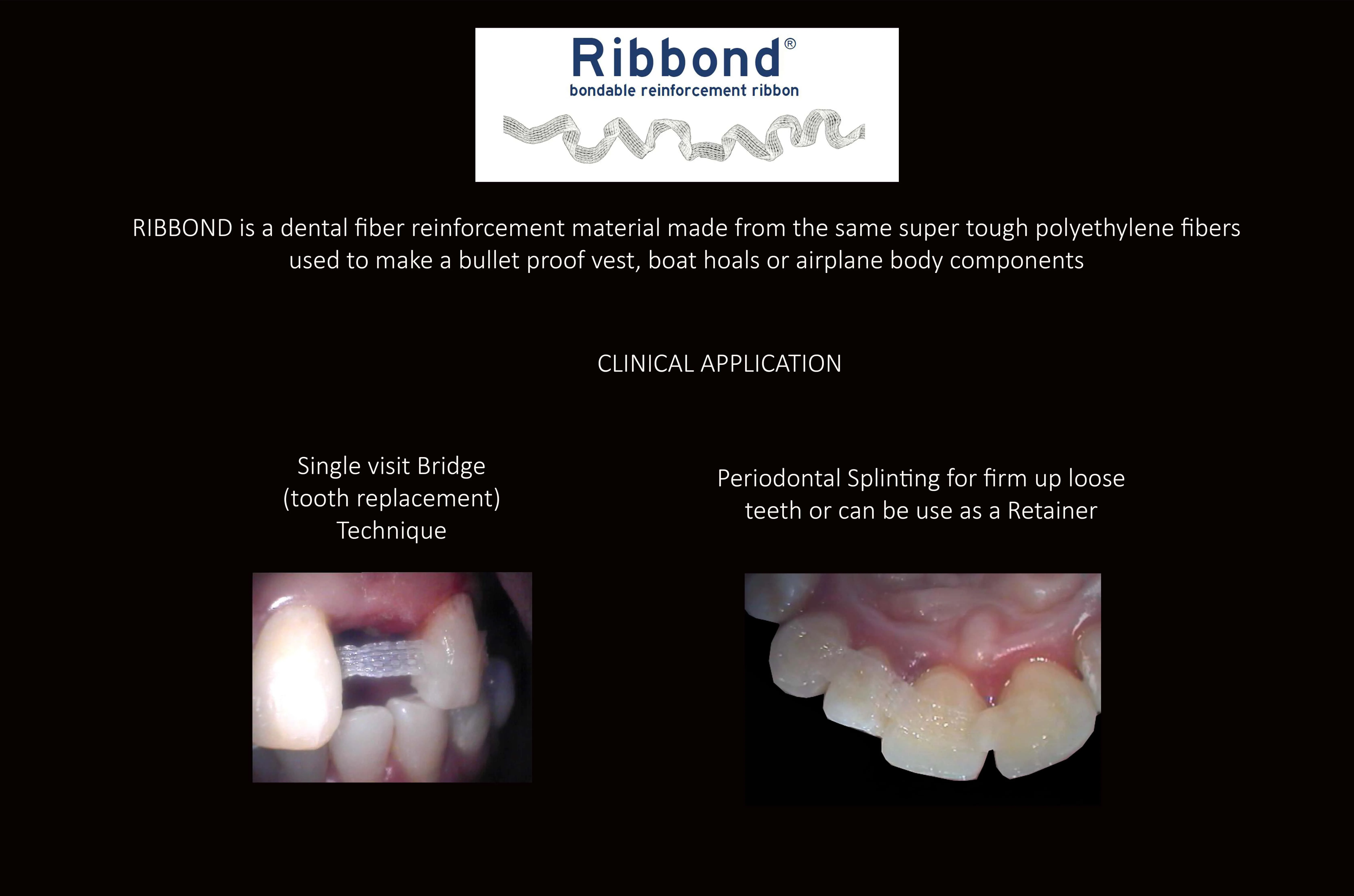 TRANSITIONAL SMILE MAKEOVER Melbourne CBD, Intermediate Cheapest most affordable Cosmetic Dentistry option to improve smile Melbourne Victoria Australia - Cosmetic Dentist Melbourne