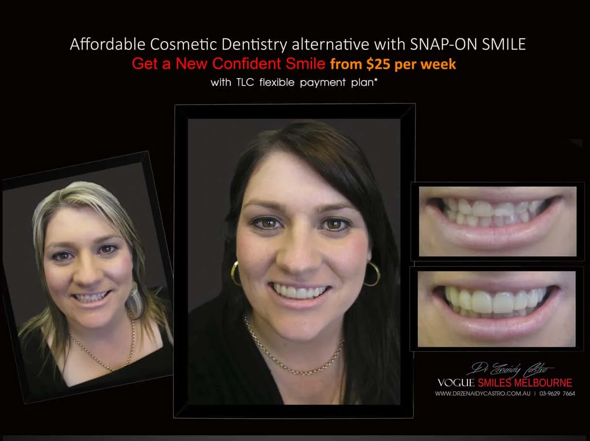 Most Affordable Way To Improve Your Smile Melbourne- CHEAPEST COSMETIC DENTISTRY SMILE MAKEOVER OPTION MELBOURNE DENTIST -Affordable Ways to Fix Your Smile and Boost Your Confidence