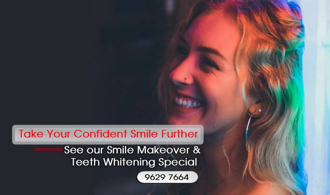 Replace Silver fillings with White, Composite Fillings Melbourne CBD