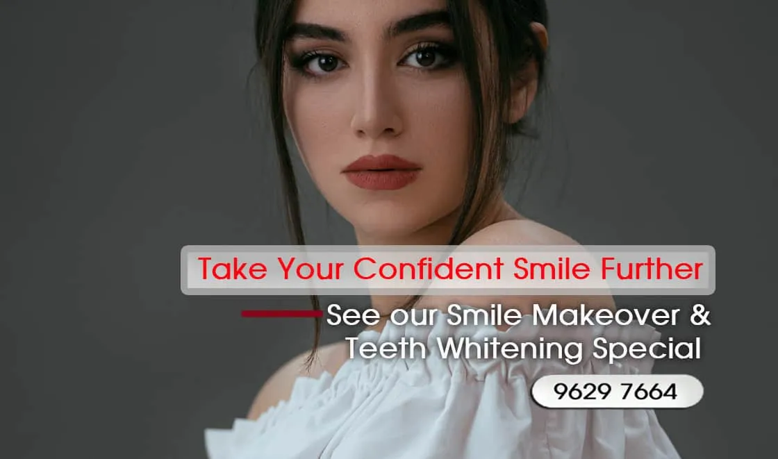 Porcelain Veneer Specials and Packages in Melbourne WITH PREPLESS / NO-PREP OR NO GRINDING -BEST DENTIST IN MELBOURNE - BEST COSMETIC DENTIST IN MELBOURNE CBD