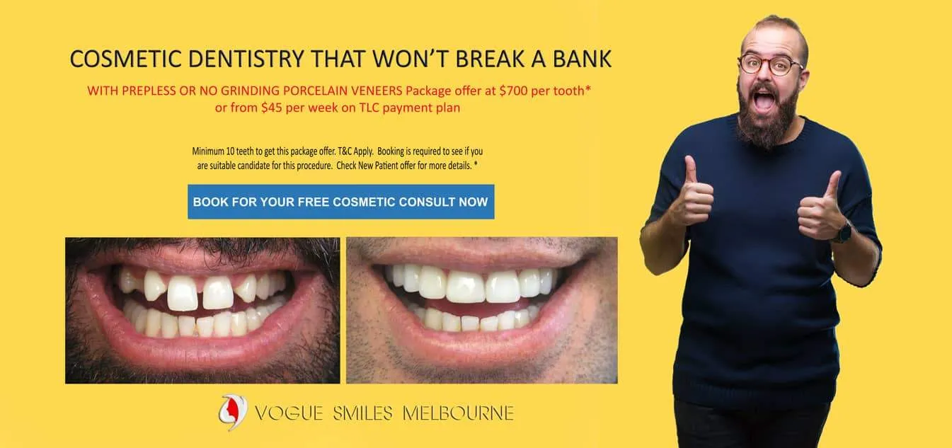 Cost of Cosmetic Dental Bonding or Composite Veneers -Cosmetic Dentist in Melbourne CBD