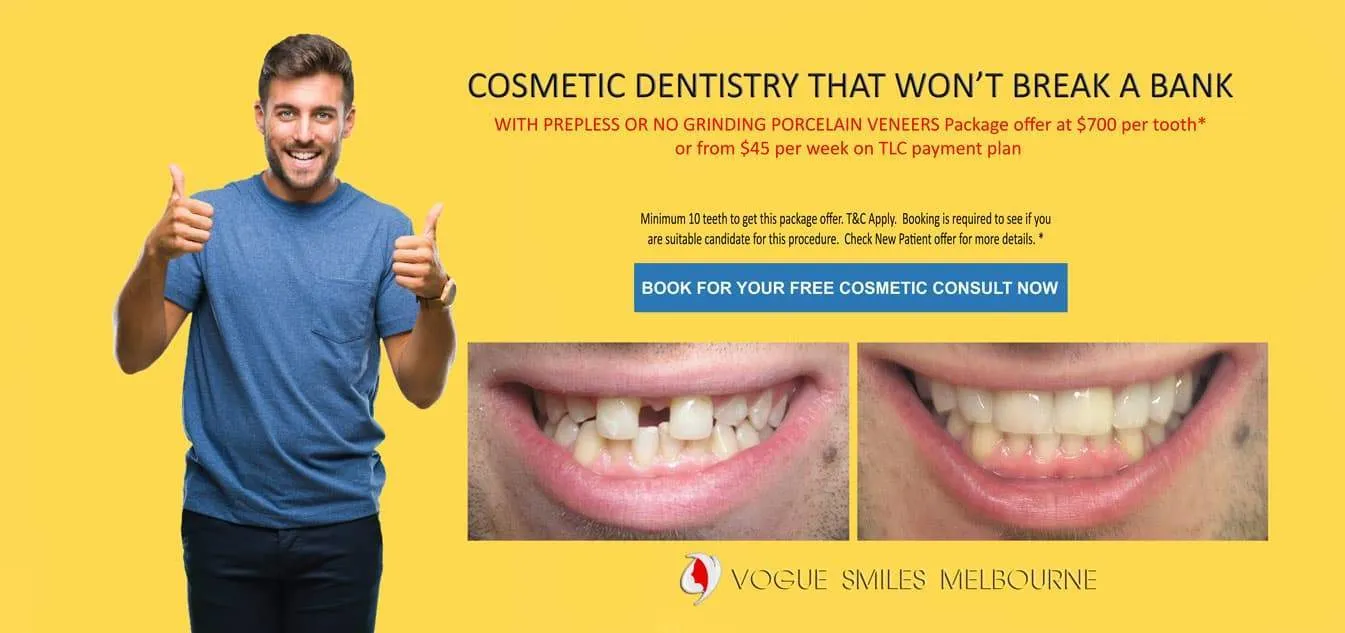 Close Gaps and Spaces between Front Teeth with Porcelain Veneer- Top cosmetic dentist in Melbourne