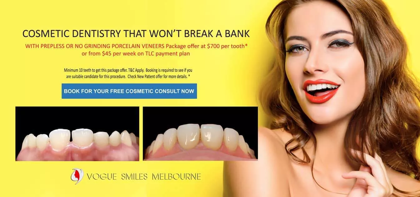 SMILE MAKEOVER PROCEDURES AND TREATMENT -Smile Makeover Melbourne, Teeth Transformation - Improve Smile Melbourne CBD Victoria Australia