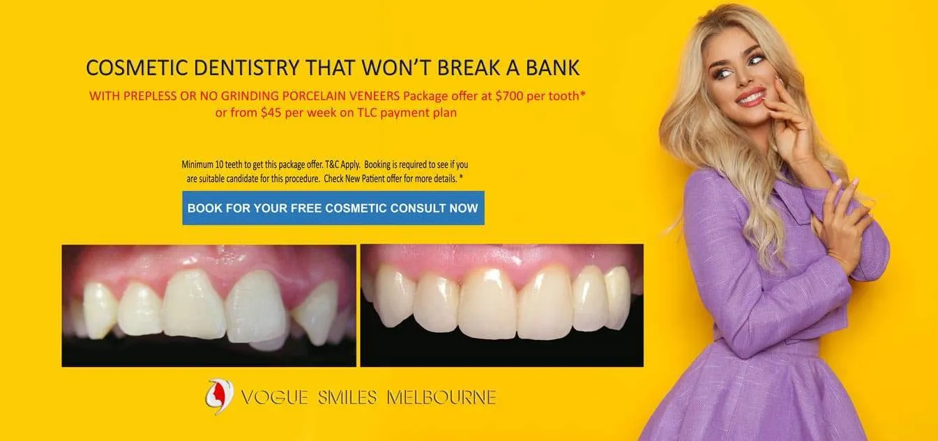 Invisalign -Clear Aligners Melbourne CBD, Invisalign cost Melbourne, Invisalign Melbourne, Invisalign payment plan, Melbourne Invisalign Experts - Invisalign Dentists - Clear Braces