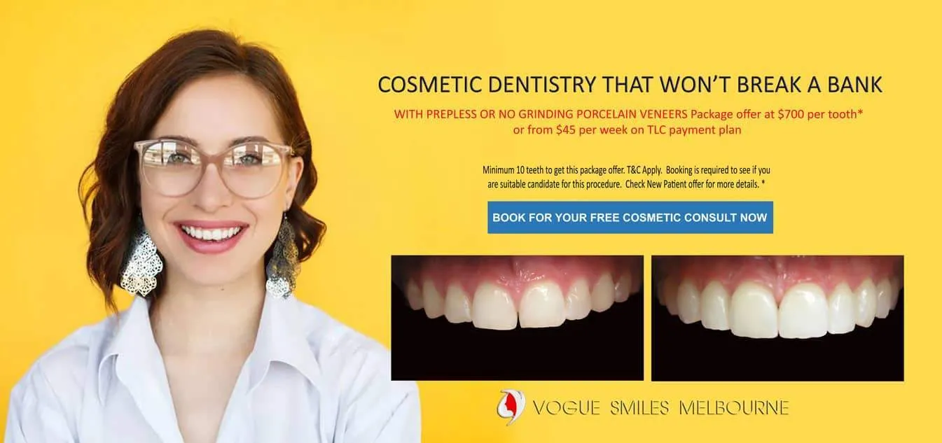 Short teeth, Worn-down, Grinded down teeth Treatment Melbourne CBD Cosmetic Dentist