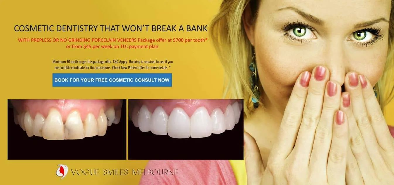 Affordable Cosmetic Dentistry with Composite Bonding Resin Veneers - Cosmetic Dentist Melbourne CBD