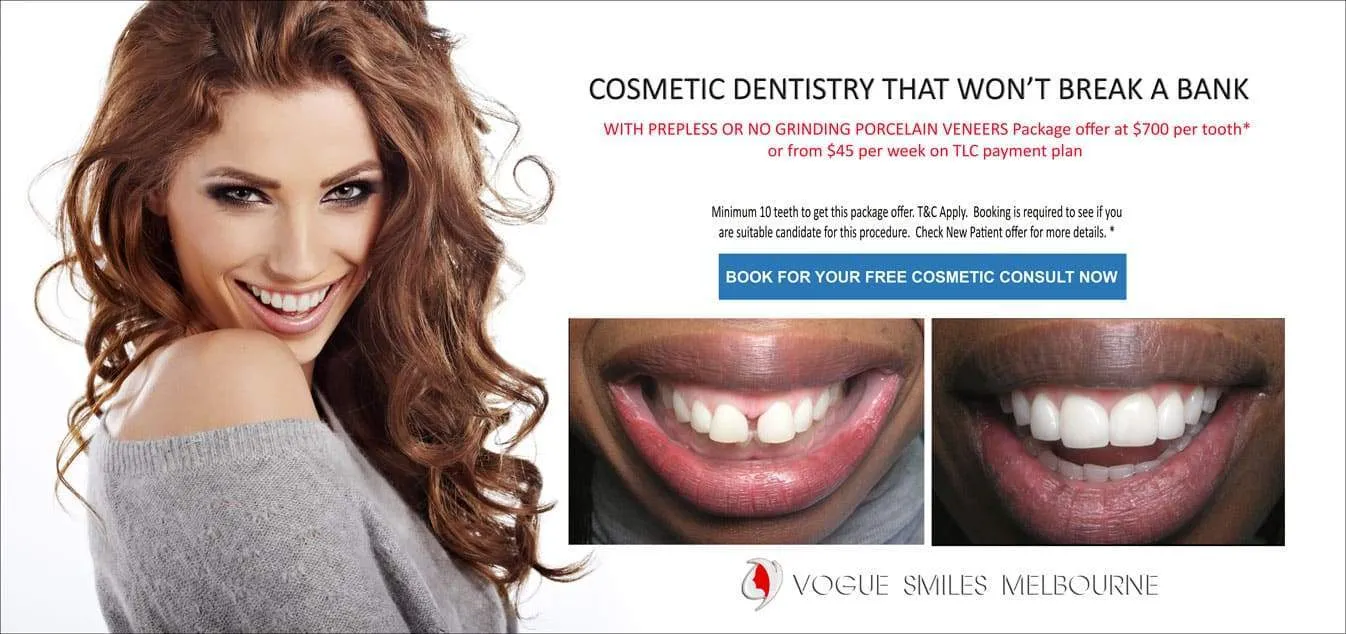 How Much Does Cosmetic Dentistry Cost in Melbourne? Cosmetic Dentistry Cost -Special Prices & Packages