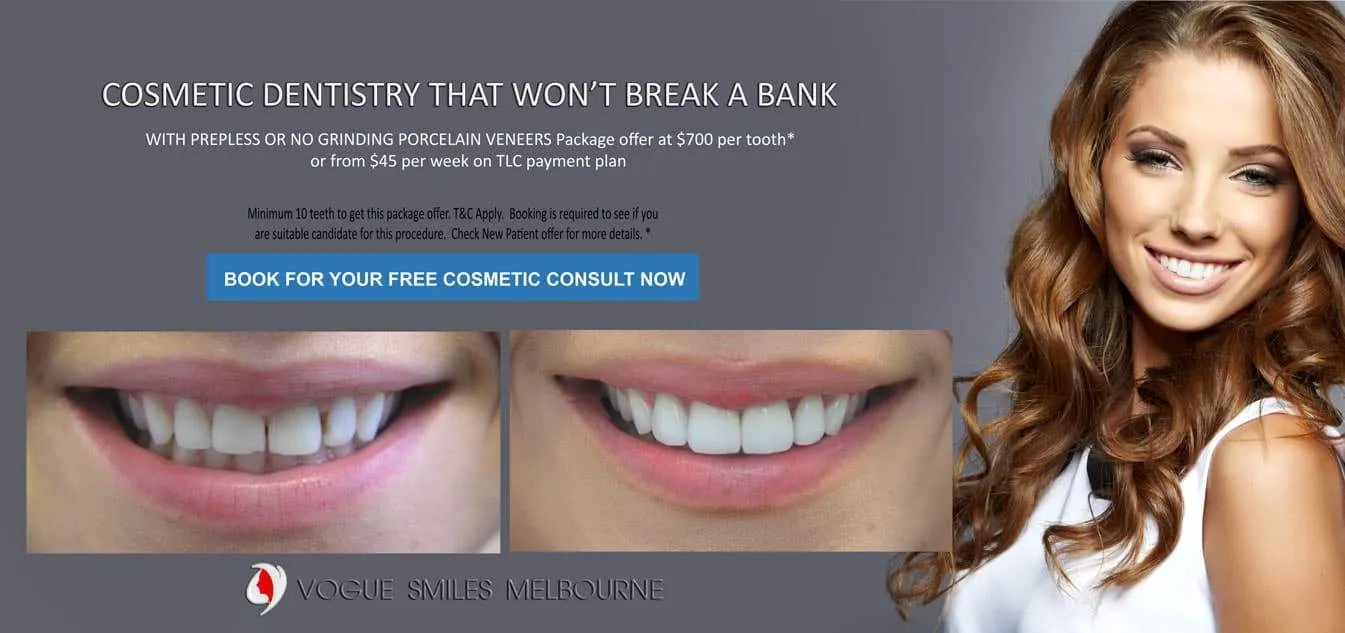 Veneers and Smile Makeovers in Melbourne CBD and Noble Park north | Lowest, CHEAPEST Price in Melbourne