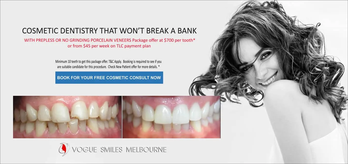 Teeth Whitening Melbourne - Teeth Whitening Specials and Packages Melbourne CBD - tooth bleaching