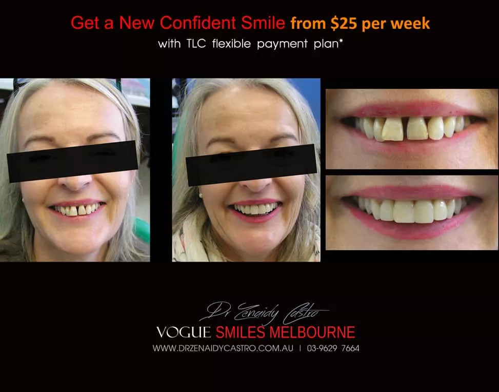 Cosmetic Dentistry Procedures and Treatments Melbourne CBD - Best Cosmetic Dentists in Melbourne, VIC -leading Australian Cosmetic Dentist