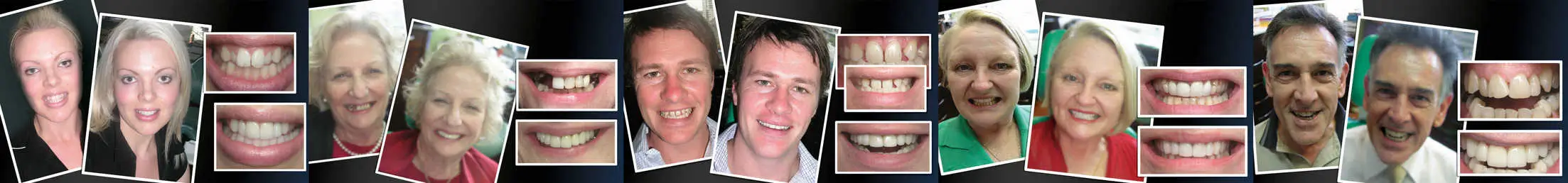 Vogue Smiles Melbourne - Vogue Dentist - Vogue Dental Melbourne -Best Cosmetic dentist in Melbourne CBD