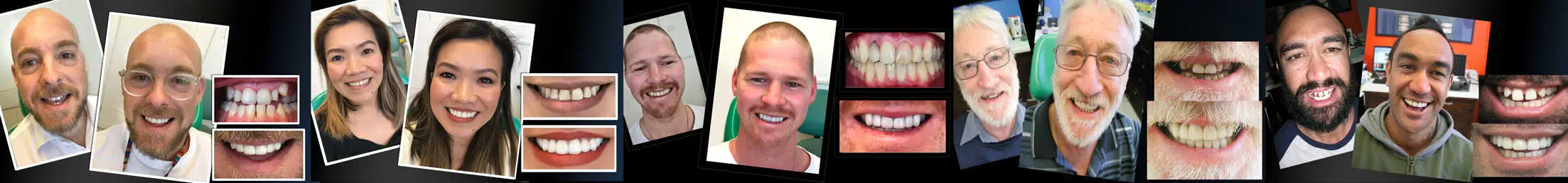 Vogue Smiles Melbourne - Vogue Dentist - Vogue Dental Melbourne -Best Cosmetic dentist in Melbourne CBD